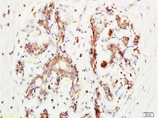 BRMS-1 Antibody in Immunohistochemistry (Paraffin) (IHC (P))
