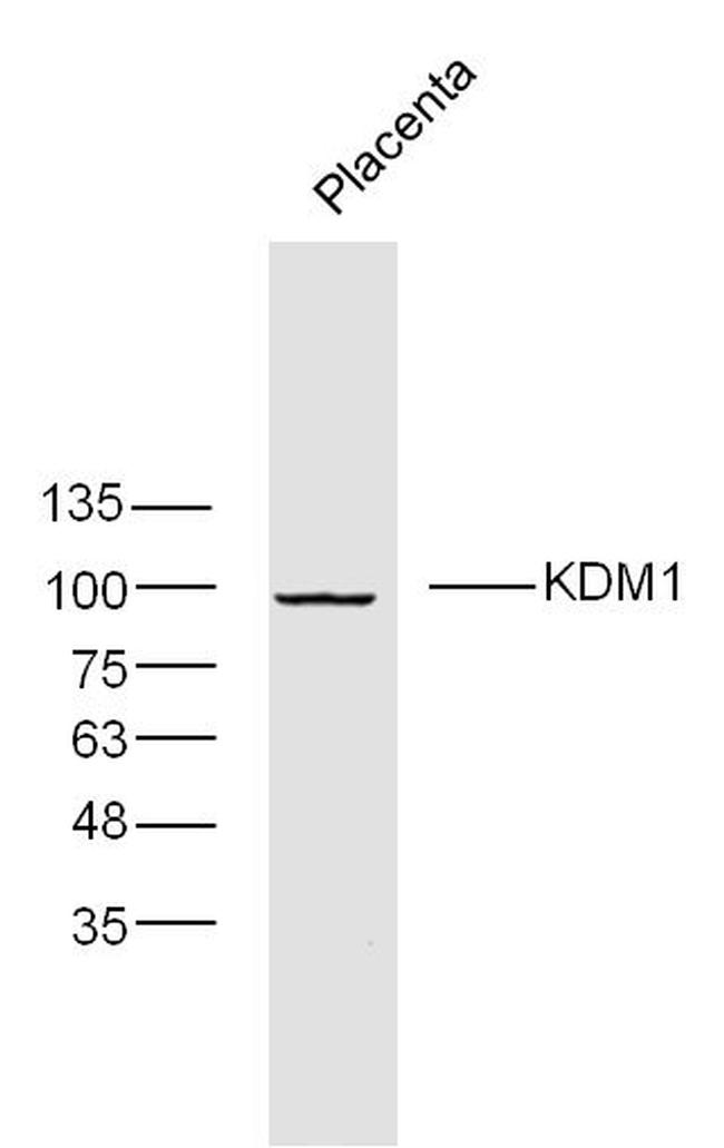 KDM1 Antibody in Western Blot (WB)