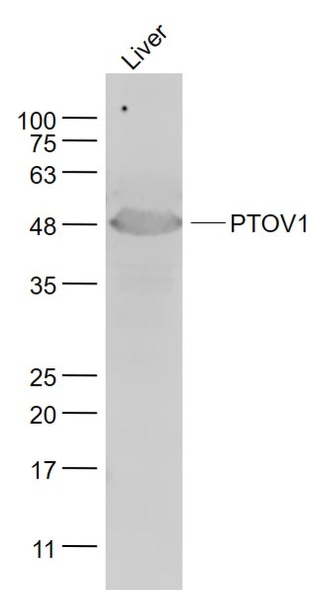 PTOV1 Antibody in Western Blot (WB)