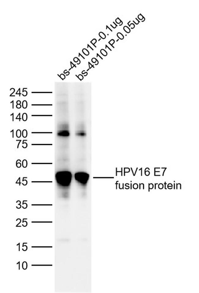 HPV16 E7 Antibody in Western Blot (WB)