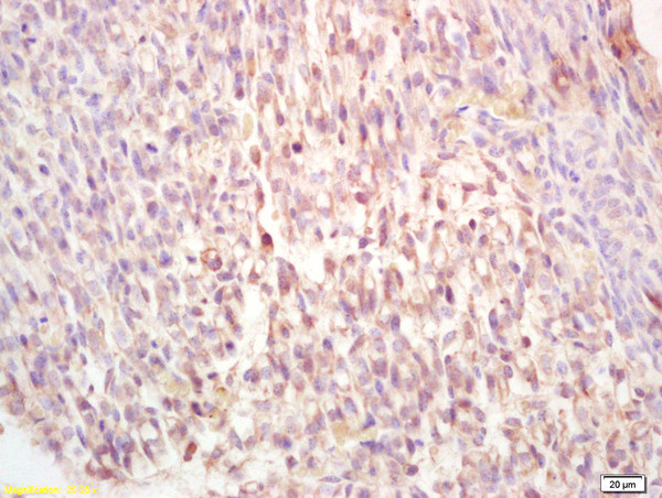 ADORA2B Antibody in Immunohistochemistry (Paraffin) (IHC (P))