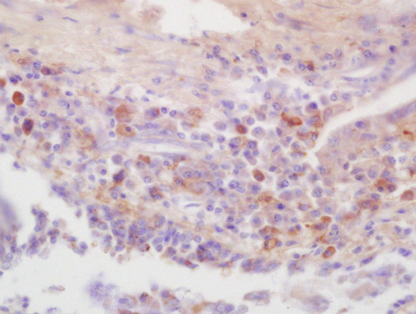 Phospho-IRAK4 (Thr345) Antibody in Immunohistochemistry (Paraffin) (IHC (P))
