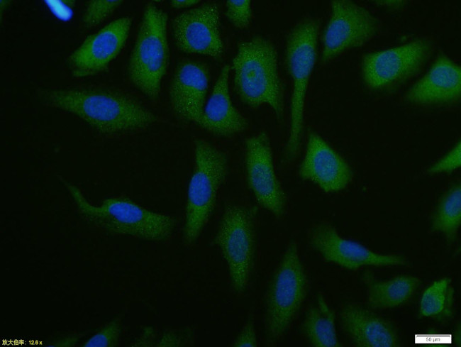 FoxP3 Antibody in Immunocytochemistry (ICC/IF)