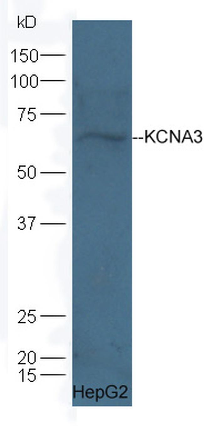 KCNA3 Antibody in Western Blot (WB)