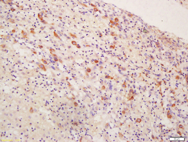 Inhibin Alpha Antibody in Immunohistochemistry (Paraffin) (IHC (P))