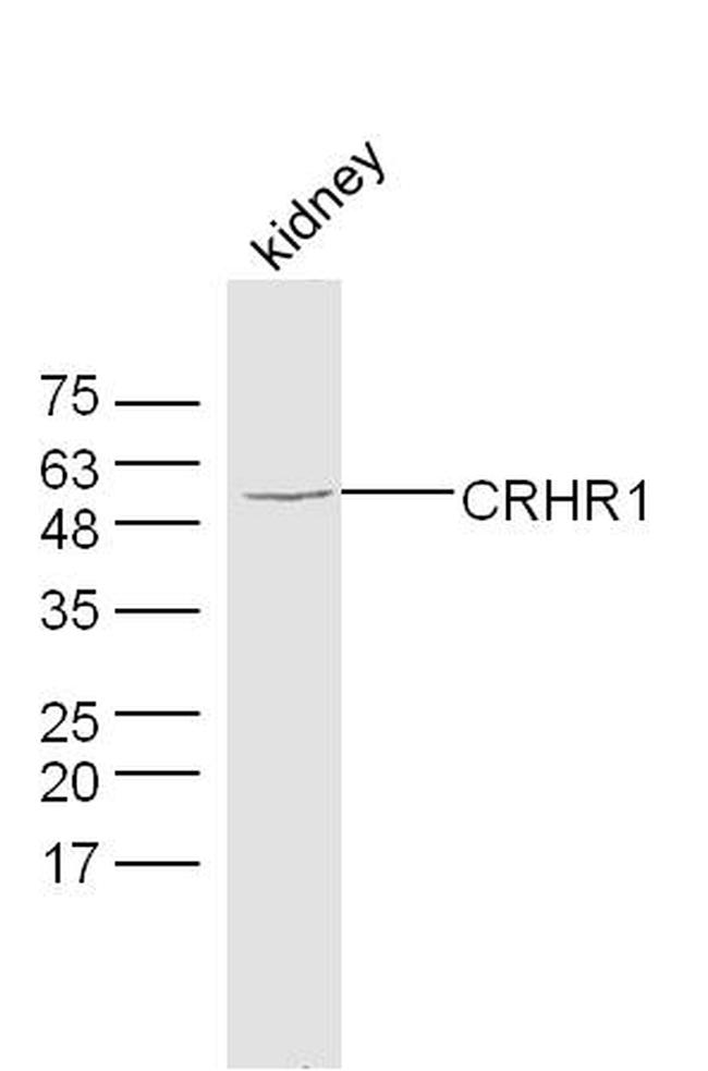 CRHR1 Antibody in Western Blot (WB)