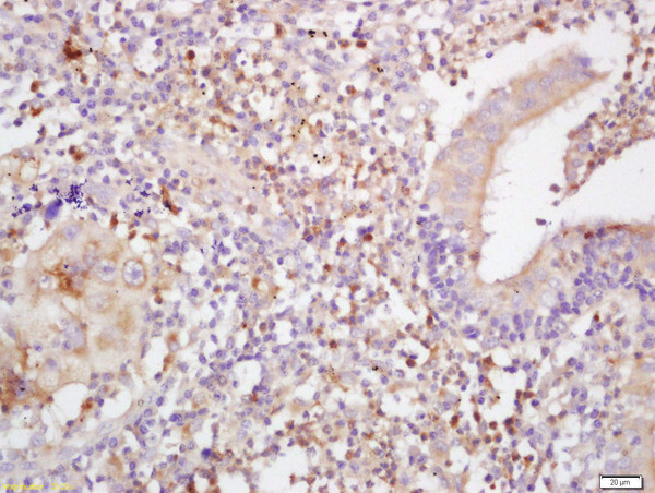 MHC class 1 Antibody in Immunohistochemistry (Paraffin) (IHC (P))