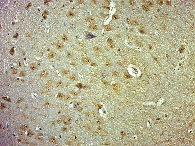 Phospho-Cofilin (Ser24) Antibody in Immunohistochemistry (Paraffin) (IHC (P))