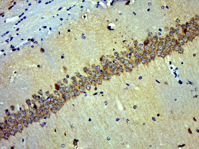 NSE Antibody in Immunohistochemistry (Paraffin) (IHC (P))