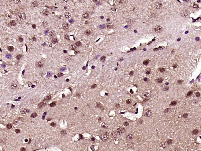 NF-L Antibody in Immunohistochemistry (Paraffin) (IHC (P))