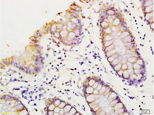 HMGA1 Antibody in Immunohistochemistry (Paraffin) (IHC (P))