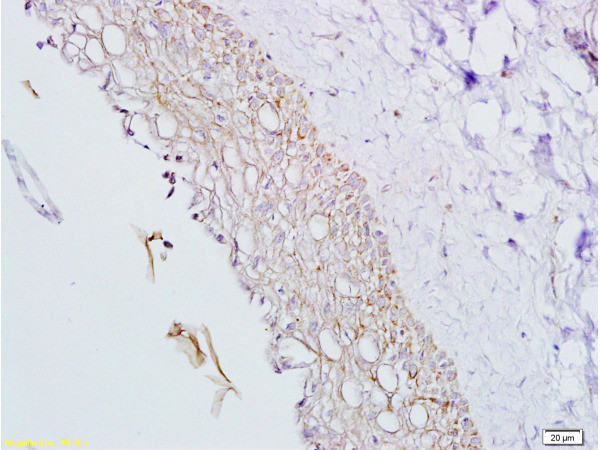 Inhibin Alpha Antibody in Immunohistochemistry (Paraffin) (IHC (P))