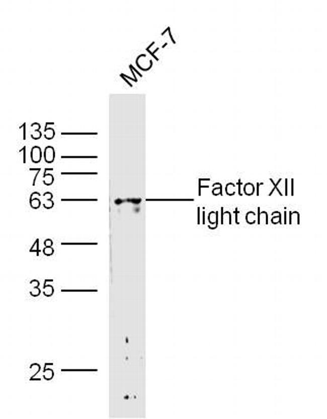Factor I heavy chain Antibody in Western Blot (WB)