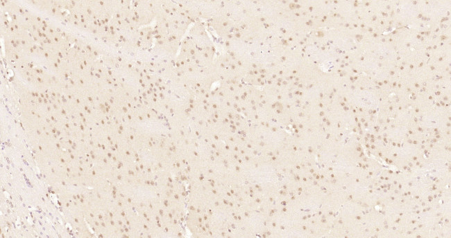 Phospho-c-ABL (Tyr204) Antibody in Immunohistochemistry (Paraffin) (IHC (P))