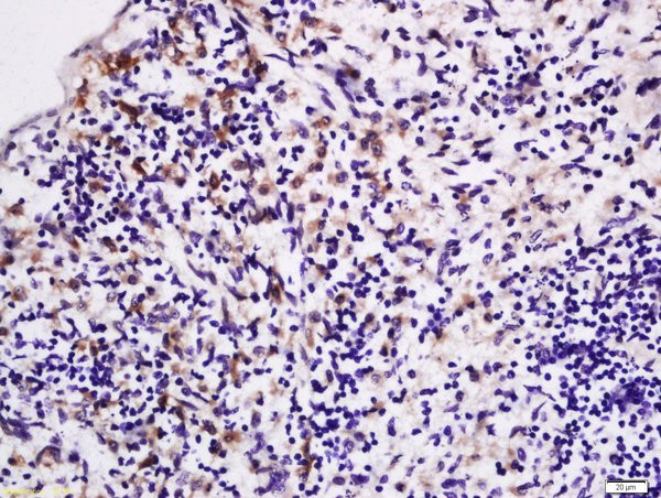 LPA2 Antibody in Immunohistochemistry (Paraffin) (IHC (P))