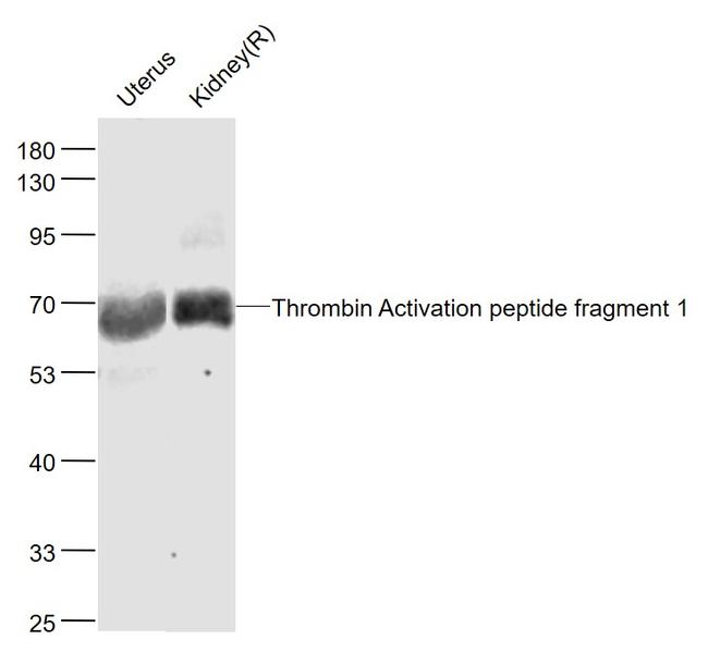 Thrombin Activation peptide fragment 1 Antibody in Western Blot (WB)