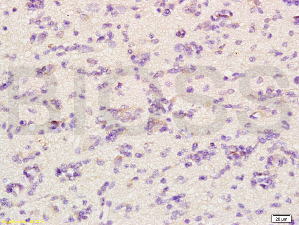 CHRNA4 Antibody in Immunohistochemistry (Paraffin) (IHC (P))