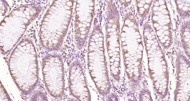 Factor 8 beta chain Antibody in Immunohistochemistry (Paraffin) (IHC (P))
