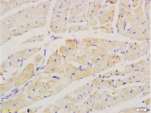 factor 5 Antibody in Immunohistochemistry (Paraffin) (IHC (P))