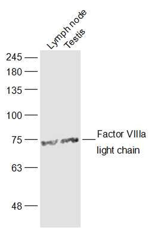 Factor 8a light chain Antibody in Western Blot (WB)