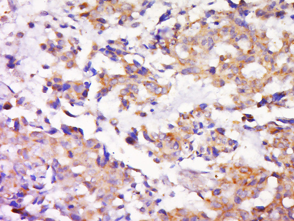 MEK1/2 Antibody in Immunohistochemistry (Paraffin) (IHC (P))