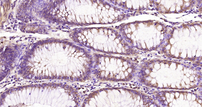 Nemo-like kinase Antibody in Immunohistochemistry (Paraffin) (IHC (P))