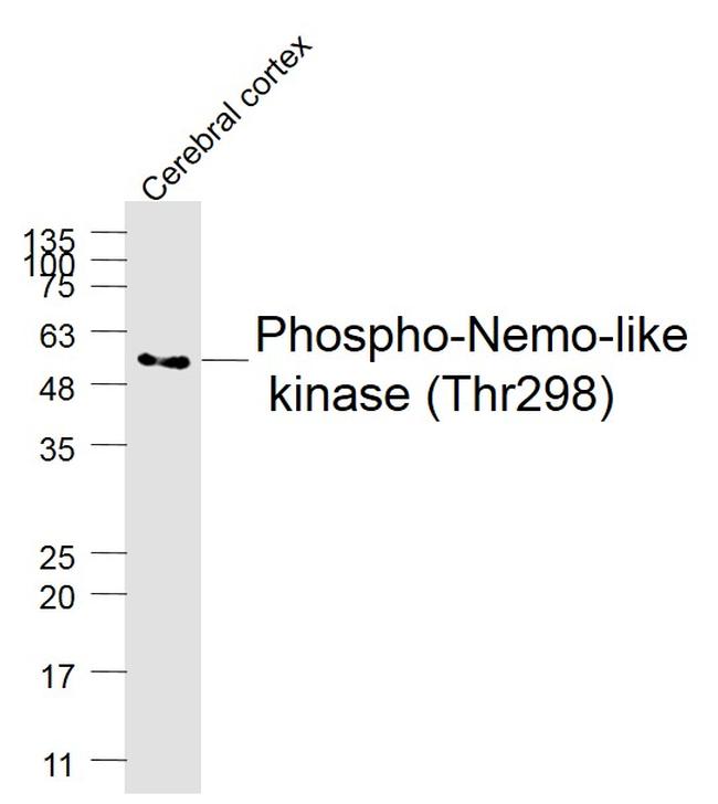 Phospho-Nemo-like kinase (Thr298) Antibody in Western Blot (WB)