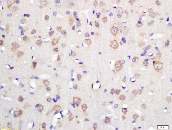 TSPAN12 Antibody in Immunohistochemistry (Paraffin) (IHC (P))