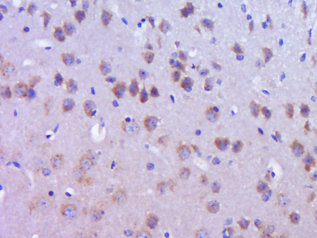 DYNC1I2 Antibody in Immunohistochemistry (Paraffin) (IHC (P))