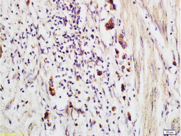CCP Antibody in Immunohistochemistry (Paraffin) (IHC (P))