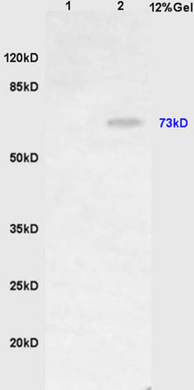 HDC Antibody in Western Blot (WB)
