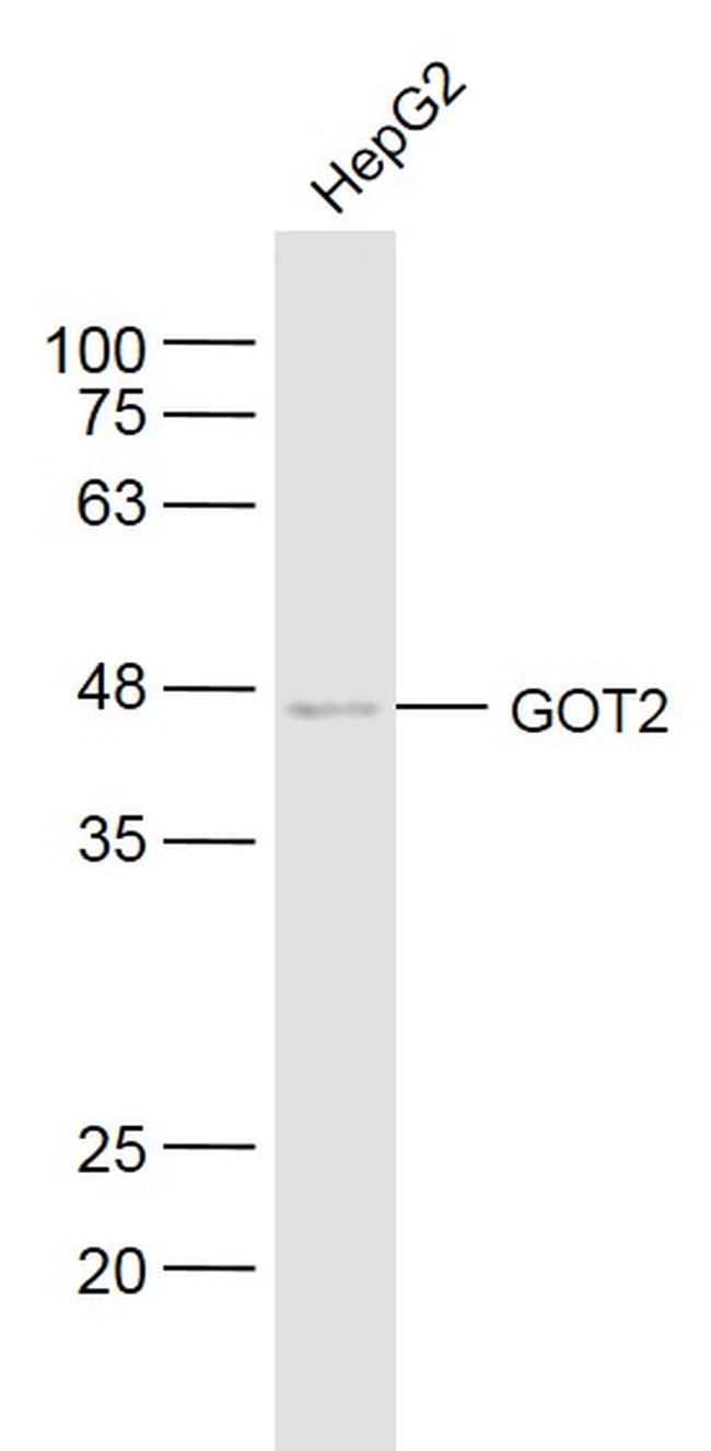 GOT2 Antibody in Western Blot (WB)