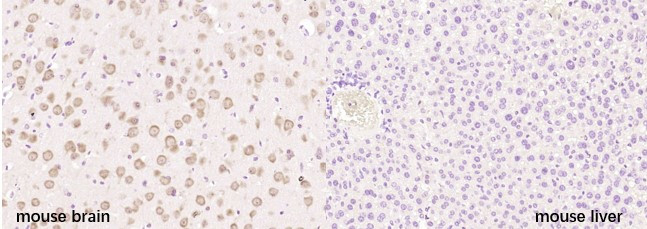 Neurocan Antibody in Immunohistochemistry (Paraffin) (IHC (P))
