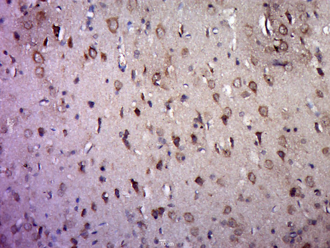 5-HTR2 Antibody in Immunohistochemistry (Paraffin) (IHC (P))