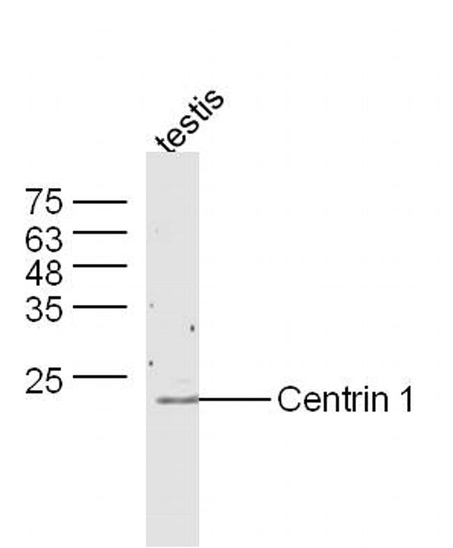 Centrin 1 Antibody in Western Blot (WB)