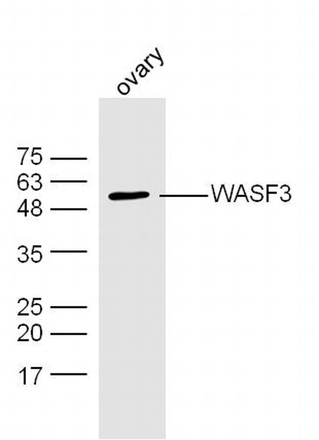 WASF3 Antibody in Western Blot (WB)
