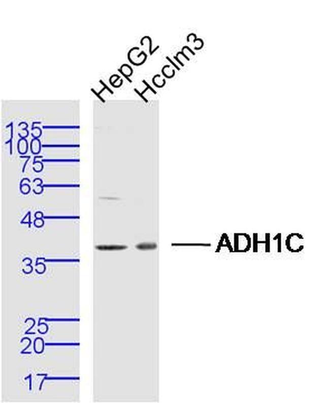 ADH1C Antibody in Western Blot (WB)