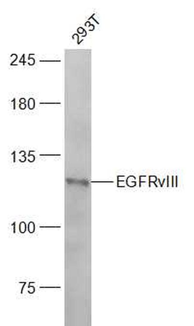EGFRvIII Antibody in Western Blot (WB)