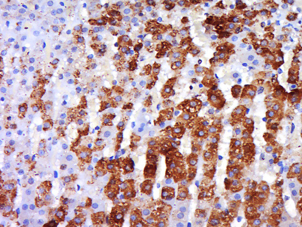 beta 3 Adrenergic Receptor Antibody in Immunohistochemistry (Paraffin) (IHC (P))