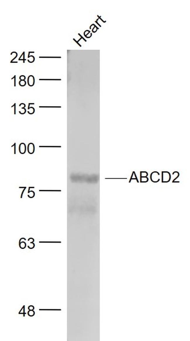 ABCD2 Antibody in Western Blot (WB)