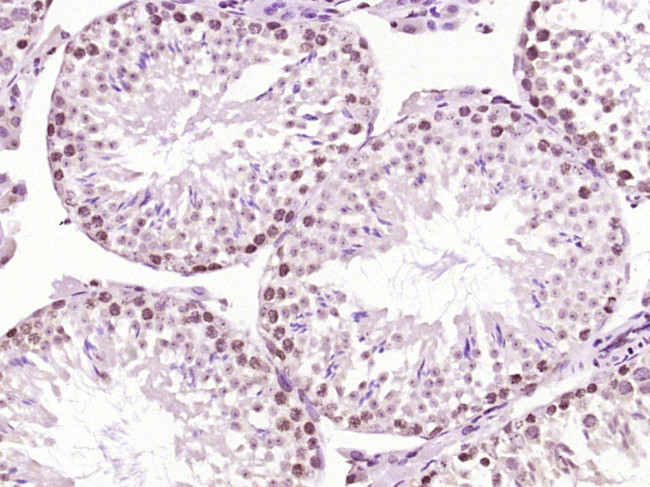 SCP3 Antibody in Immunohistochemistry (Paraffin) (IHC (P))