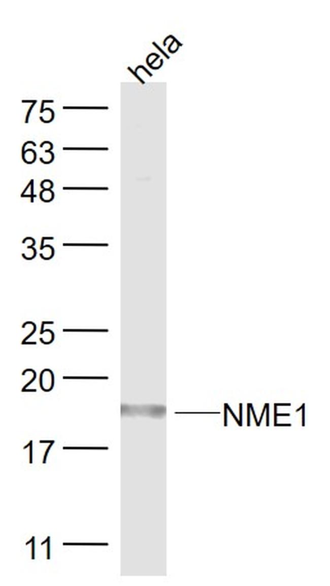 NME1 Antibody in Western Blot (WB)