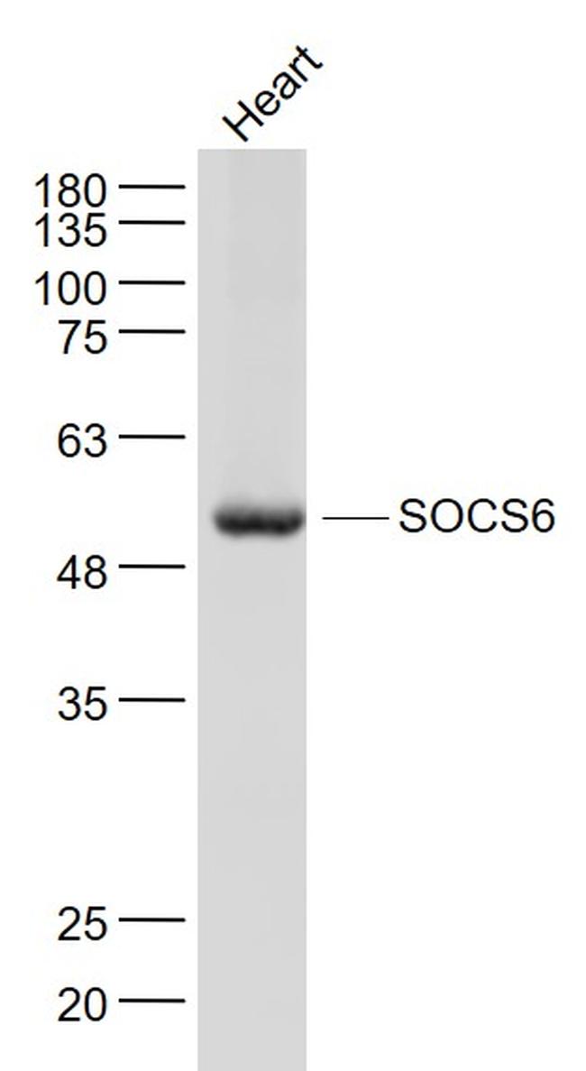 SOCS6 Antibody in Western Blot (WB)