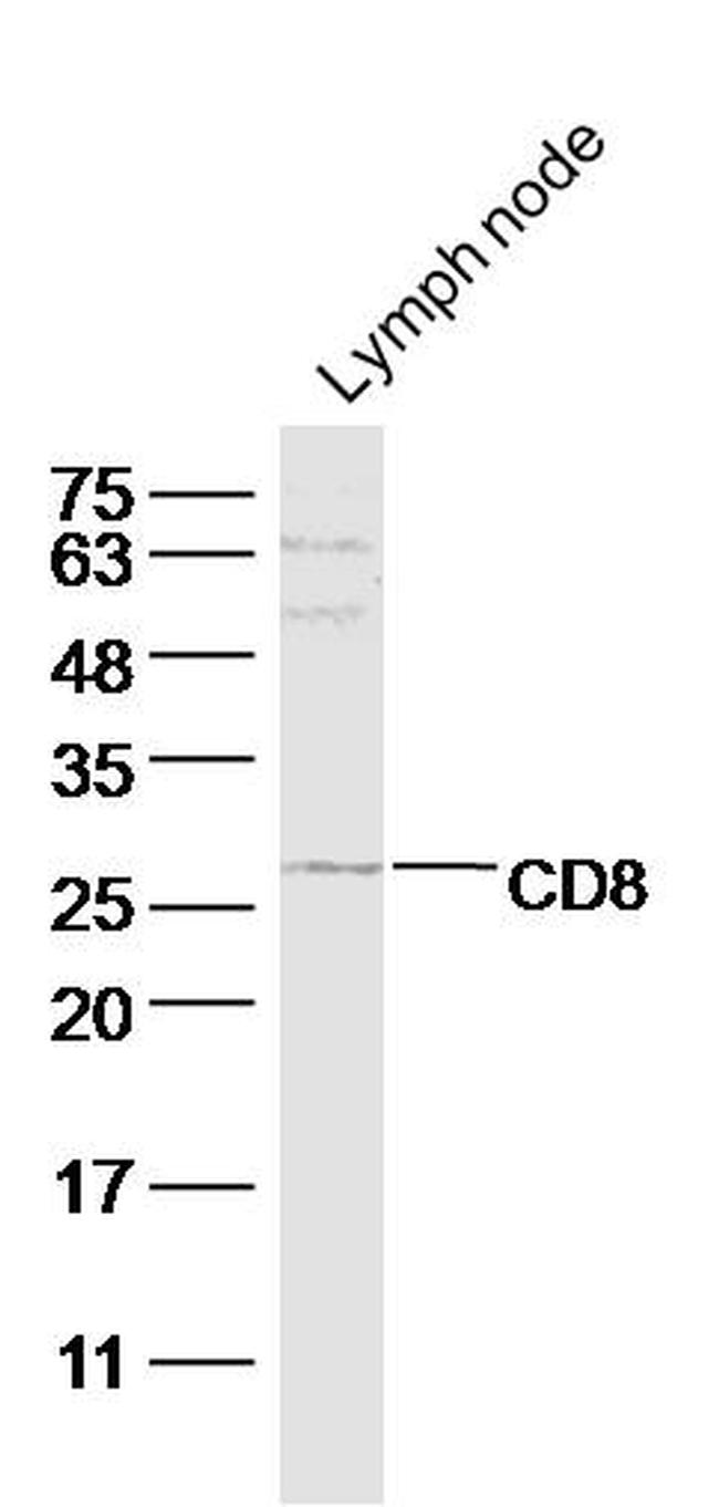 CD8 Antibody in Western Blot (WB)