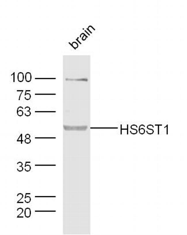 HS6ST1 Antibody in Western Blot (WB)