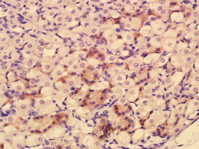 HRAS Antibody in Immunohistochemistry (Paraffin) (IHC (P))