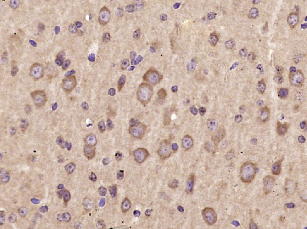 AKT2 Antibody in Immunohistochemistry (Paraffin) (IHC (P))