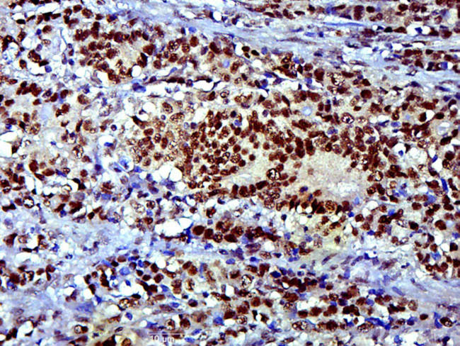 SOX9 Antibody in Immunohistochemistry (Paraffin) (IHC (P))