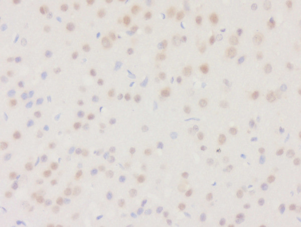 DHRS2 Antibody in Immunohistochemistry (Paraffin) (IHC (P))