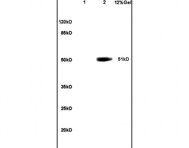 OCT2 Antibody in Western Blot (WB)